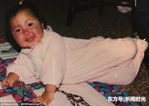 美国女子满脸胎记从小遭歧视,为改变多年苦练化妆术惊艳旁人