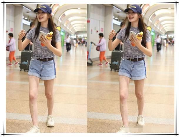 林允太奇葩了，满腿都是小疙瘩还敢穿短裤，网友:到底怎么想的?