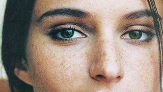  『女士』女士最容易长斑的4个阶段，你躲过去了吗？