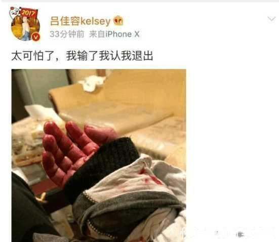 演员吕佳容爆出Q姓男星死因真相, 网友倒吸一口气, 娱乐圈水太深