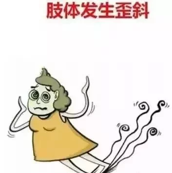 脑血栓当天,身体会发送6个暗号,收到1个就能救命,为家人看一眼! - 望天吼 - 望天吼sdr-937803335@ 脑血栓当天,身体会发送6个暗号,收到1个就能救命,为家人看一眼! - 望天吼 - 望天吼sdr-937803335@