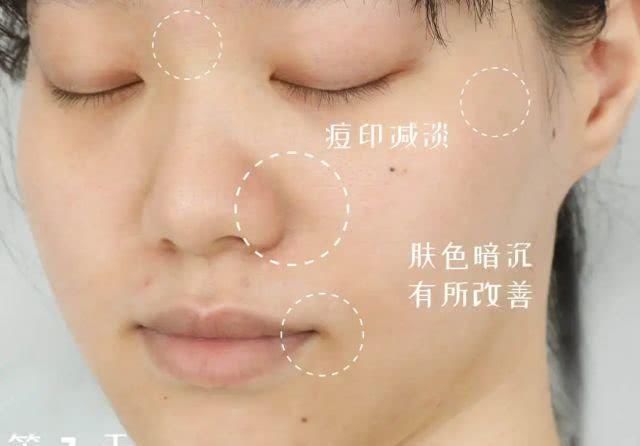  「网传」网传的护肤“黑科技”真的可以养出素颜无瑕肌吗？