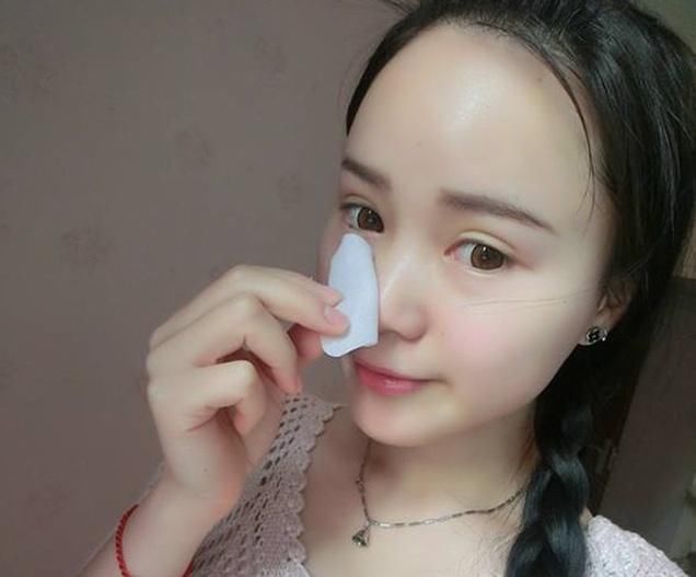 有人爆出祛斑偏仿，每晚用它抹下脸，仅用三天斑点呲溜溜走