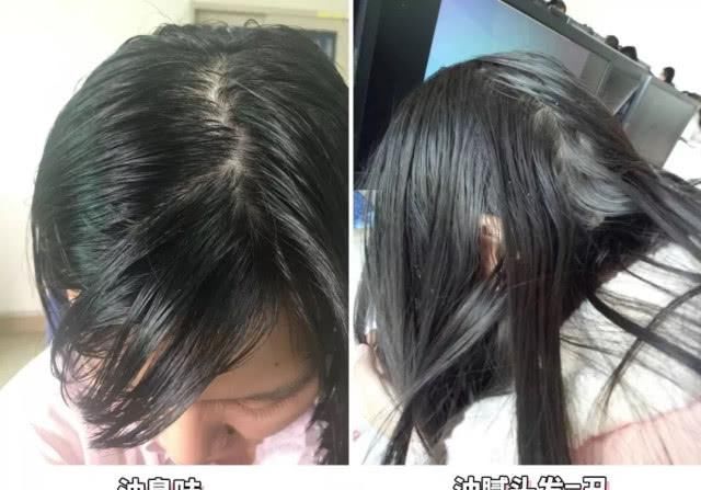  [气质]气质女孩必学颅顶增高术！发量增加变小V脸，哪里还用遭罪减肥