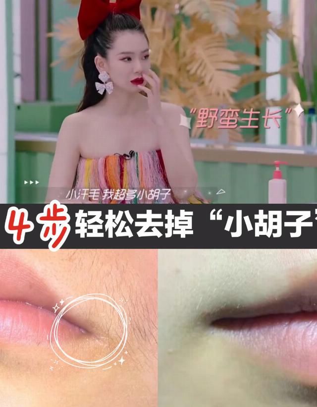 「招给」道别唇周黑,4招给你有着仙子唇