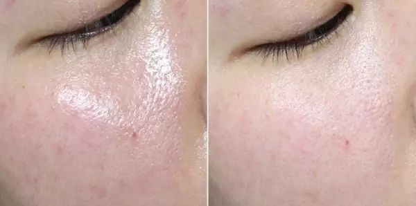 性价比逆天!大瓶好用的湿敷新宠，美白补水缩毛孔，0差评，上架就