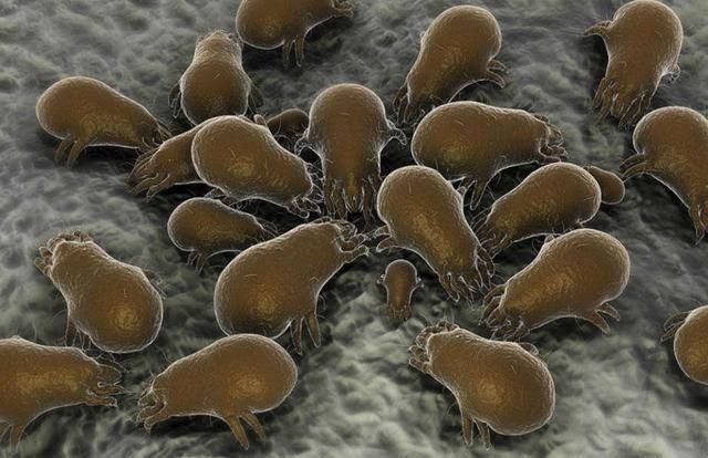 敷面膜用乳霜就长痘?可能你在喂养螨虫!