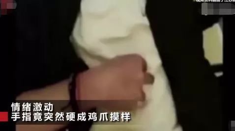 [真的]和女友吵架一时爽，男子手指变鸡爪：这不是装的，真的是病！