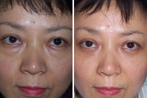 医学院博士泄密:睡前擦点药店“碱性药膏”,眼袋、眼纹不再找你