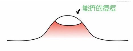 什么切乳房,烤肉,脂肪瘤,女明星写才是谣言重地