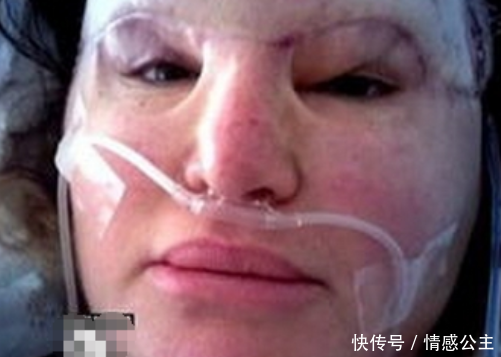 40岁的女人不顾反对，坚持整容，手术失败后丈夫的做法令人意外
