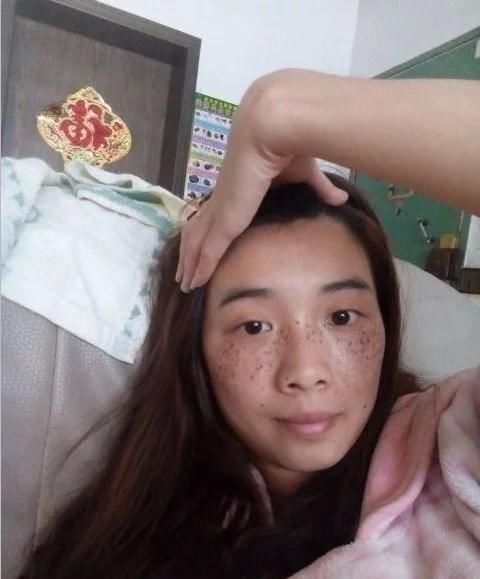 斑点问题，可以学学这几招祛斑有效