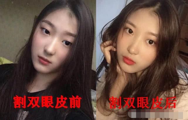 好看|割双眼皮前VS割双眼皮后,看见差距,眼睛变好看了但灵魂没了!