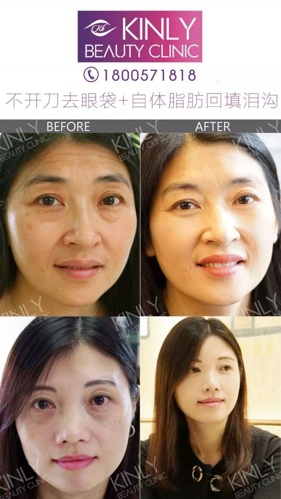 为何“老阿姨”萧亚轩总能交到小鲜肉男友?她的斩男秘籍到底有哪