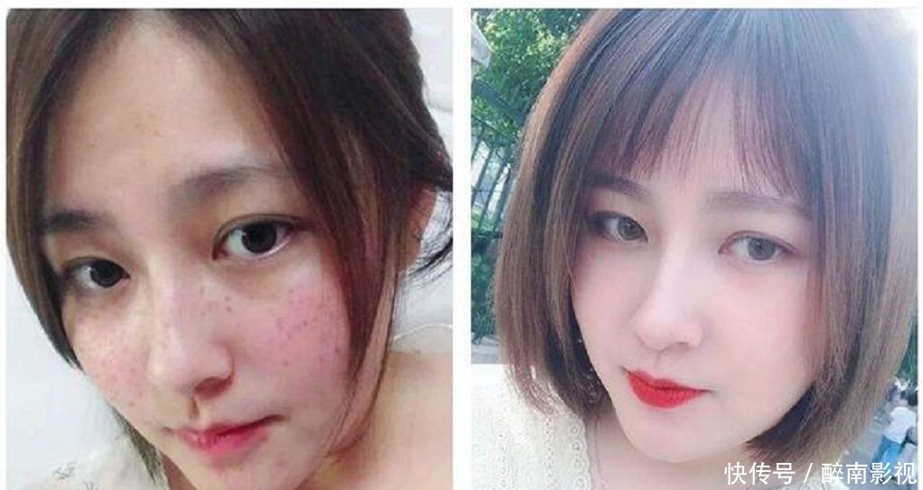 『脸上』女生脸上有色斑,教你一招用生姜加它敷脸,15天轻松告别色斑脸!
