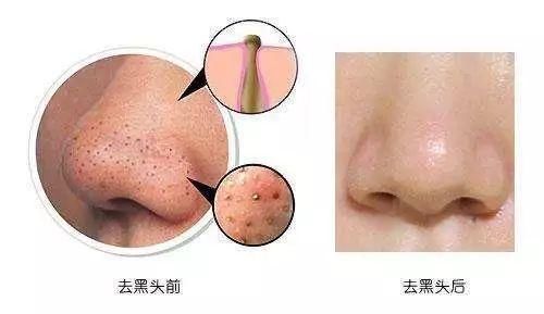 每个女人都希望青春永驻