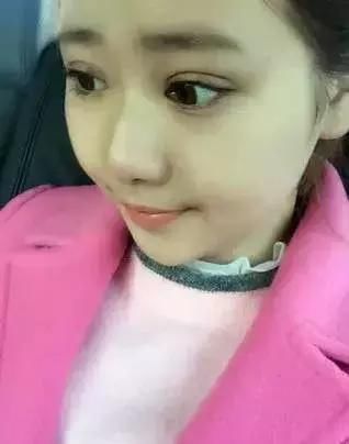 双眼皮+开眼角=我魅力大眼！