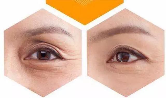 抖音眼:同样是眼睛,拯救全脸和祸害颜值的眼睛区别还真大