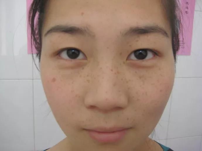 《如懿传》周迅的囧途，你若同有，一步治好!