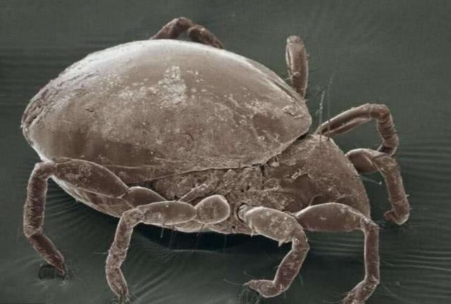 脸上爱长“白色颗粒”,说明上万螨虫挖开毛孔,简单去除只需3招