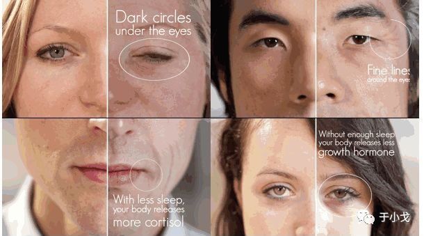 曝大S童年"黑"历史,拼命美白会有害健康么?