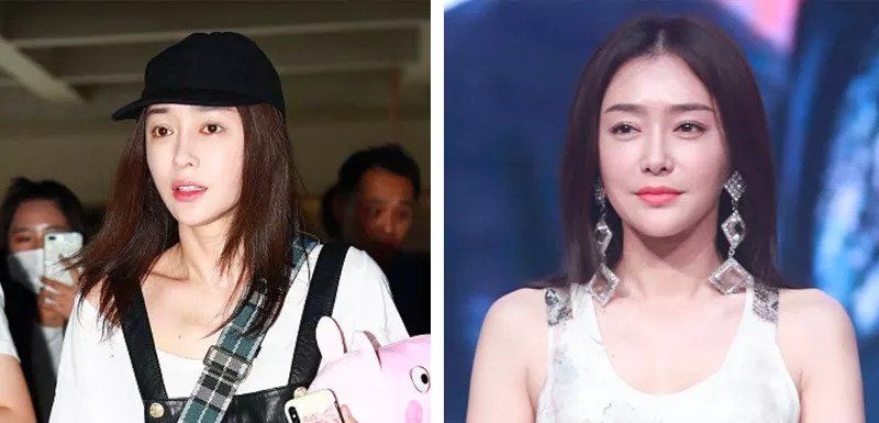 秦岚15年前被喷绿茶婊，如今“白月光”霸气回应整容谣言再度翻红