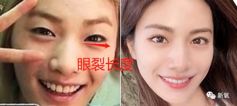  『最美脸蛋』做了不下10项整形手术，却从没脸崩过的亚洲第一美人，服气！