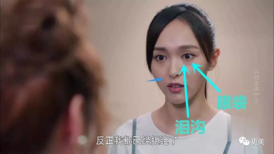 90后的郑爽关晓彤眼袋都要掉地上了，快来个医生救救她们吧!