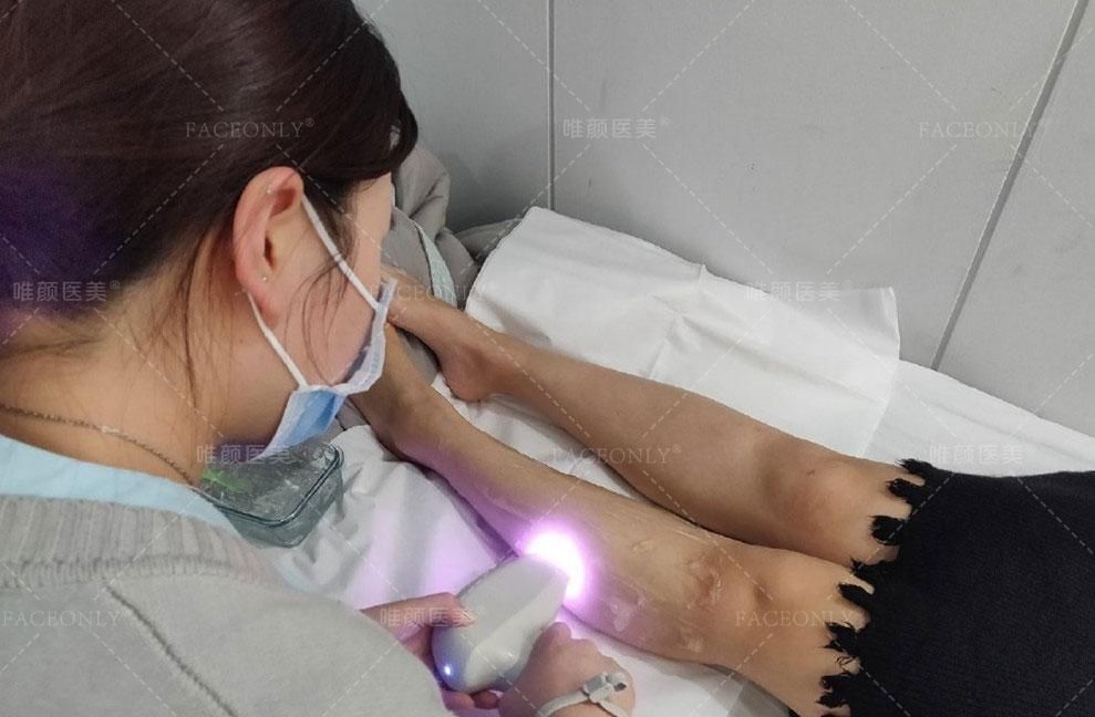 「脱毛」来一次严格意义上的脱毛,对你有多重要
