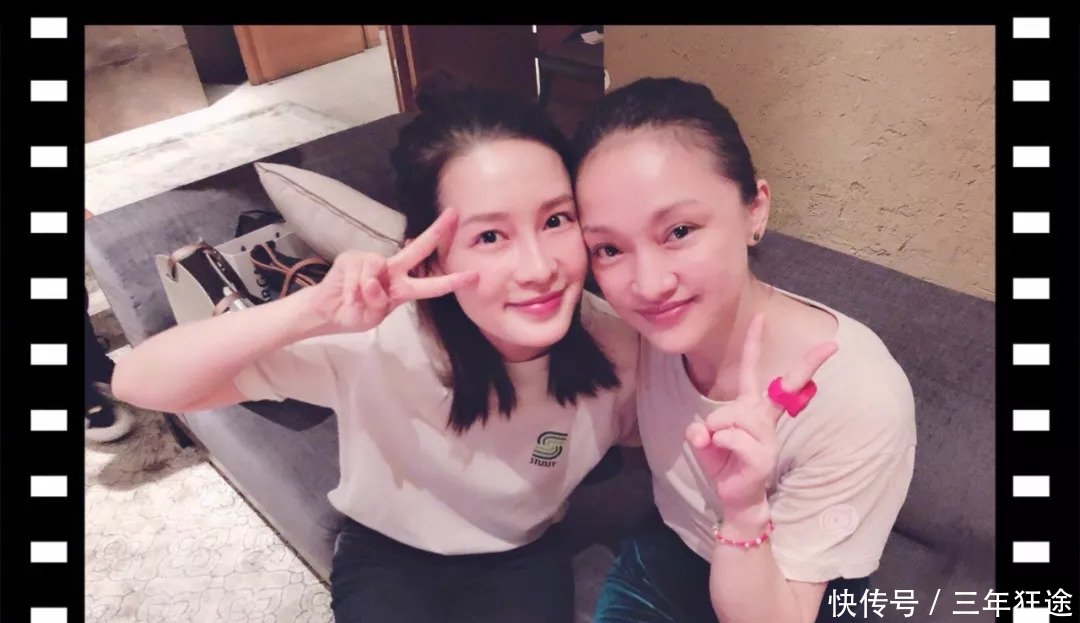 90后郑爽的黑眼圈比周迅都严重？眼部保养要重视了！