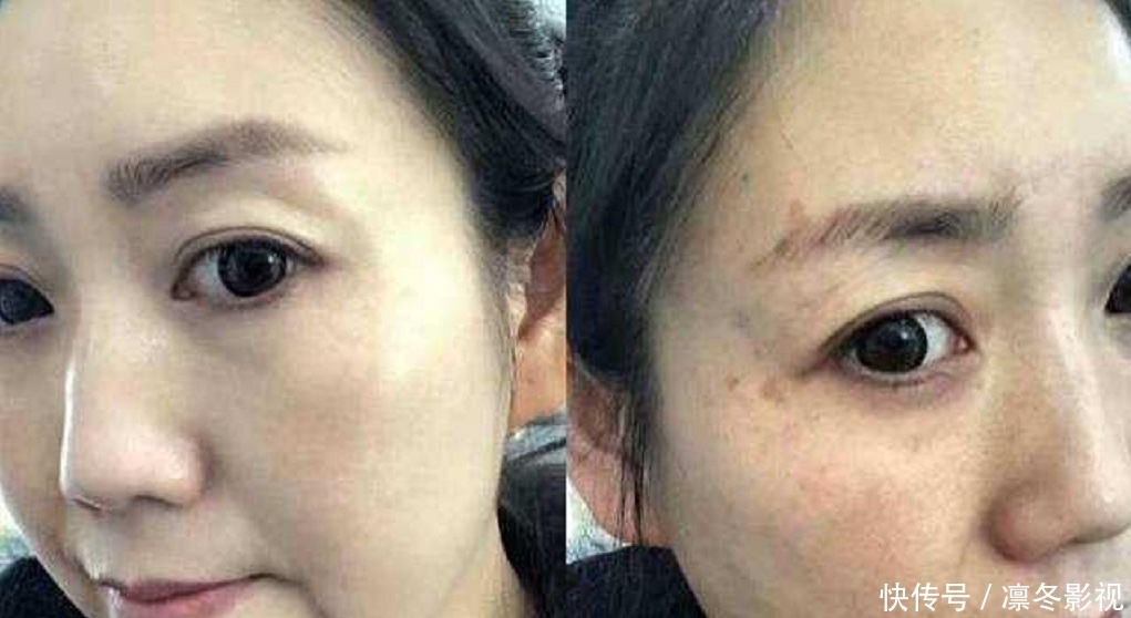  #脸部#凡士林加“它”涂抹脸部，淡斑去皱又嫩肤，15天皮肤变得白净细腻