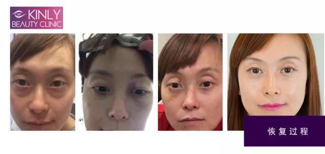 为何“老阿姨”萧亚轩总能交到小鲜肉男友?她的斩男秘籍到底有哪