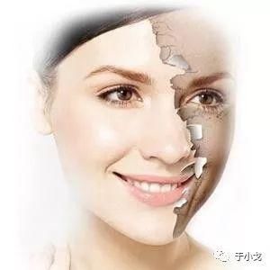 曝大S童年"黑"历史,拼命美白会有害健康么?