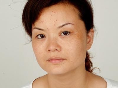 开塞露配上这不起眼的小白片，抹脸效果都说好，太厉害了