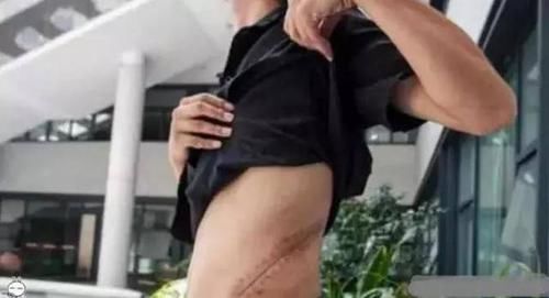 苹果都出11了,当初割肾买苹果4的小伙子,如今