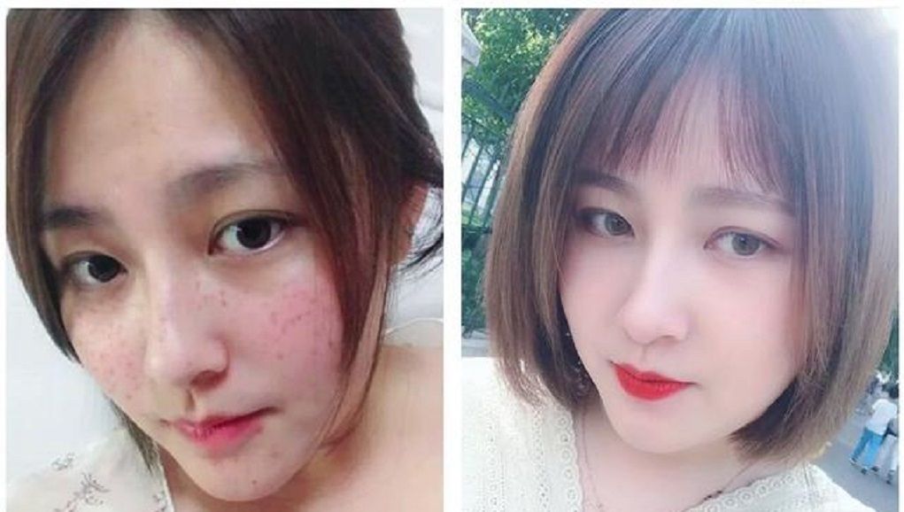  [白嫩]蜂蜜加它坚持敷脸,一周使用三到四次,美白嫩肤效果比买的好