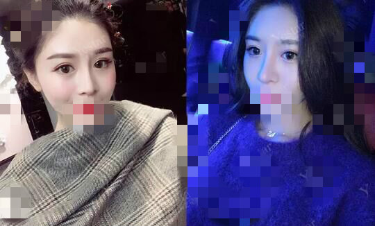 北京艺星割双眼皮确实是对的选择，气质好了