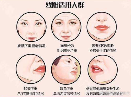  症状：埋线提升恢复期有什么症状吗？
