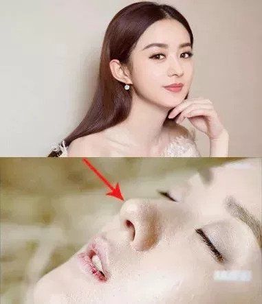 几十块就能收毛孔!这支超好用的“磨皮原液”，连我的黑头也治好