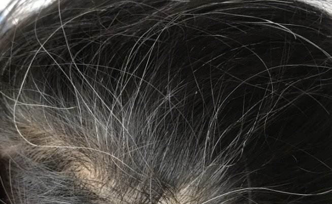 乌发■头上有白发不要去染,交给你们一个小妙招,坚持下去白发慢慢变黑