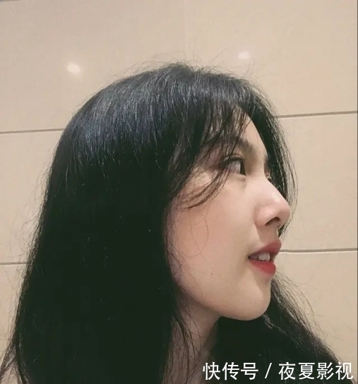  『找到』痘痘肌应该怎么办？找到原因是根本，选对护肤品很关键，你知道吗