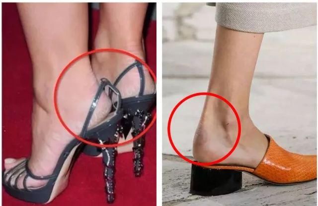 擦掉一张皮，双脚换皮术！死皮、老茧一喷就没，15秒还原嫩白玉足