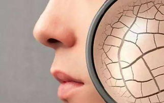  【去角质】敷面膜有刺痛感都是皮肤缺水导致的吗？