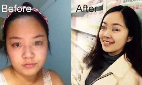 131斤二胎妈妈，为减肥连吃30日红豆，现在体重不到百斤！