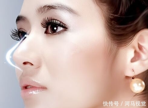  『鼻翼』鼻翼缩小手术会留疤吗