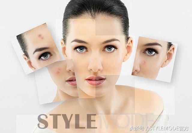 过度保养不会让你更美，却会让你发生皮炎和敏感