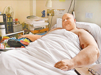 世界最胖男子体重445公斤，用铲车才可以出门，今减肥292公斤!