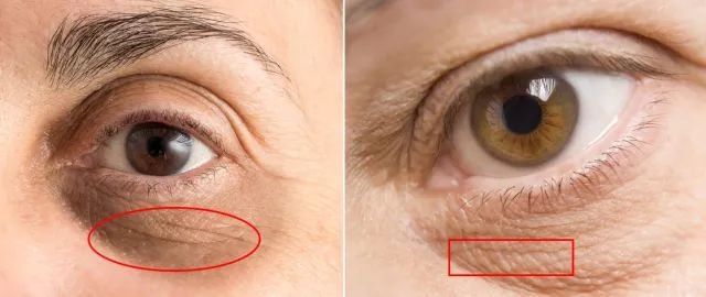 你的眼睛若亮了，生命就亮了