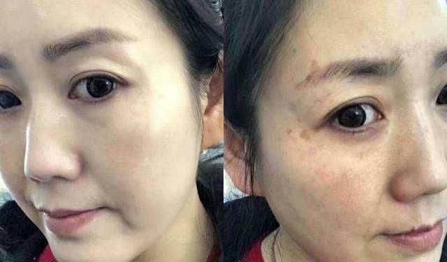  「白皙」啤酒加“它”敷敷脸，一个月轻松淡斑除皱，皮肤变得白皙又光洁