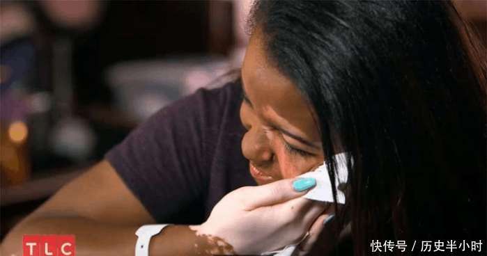 她患白斑症躲粉底下7年，当决心卸妆后，网友惊呼美呆了！